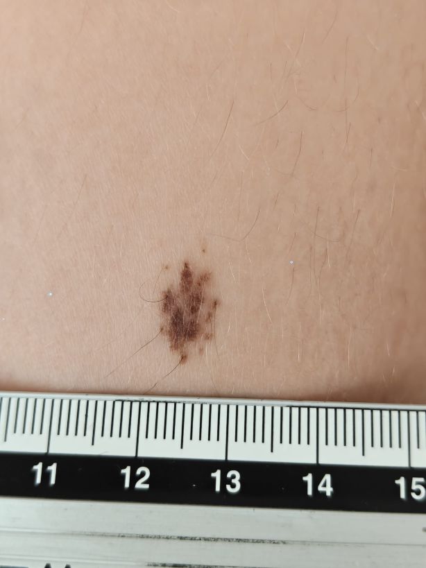 Example: spot with ruler in view